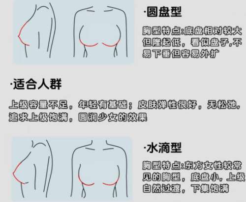廖云君医生口碑怎么样？隆胸/双眼皮等技术解析！含2026价格表