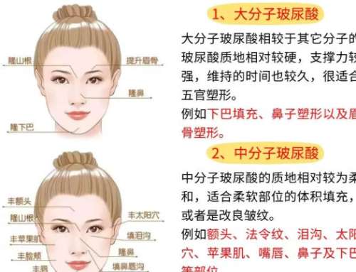 注射美容 注射美容