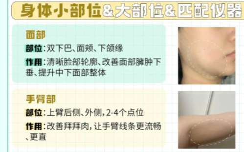 面部吸脂 面部吸脂