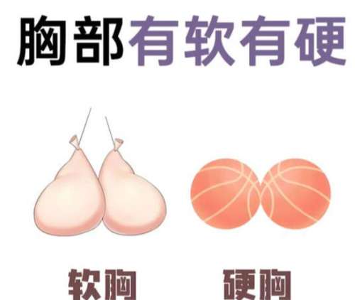 隆胸 隆胸