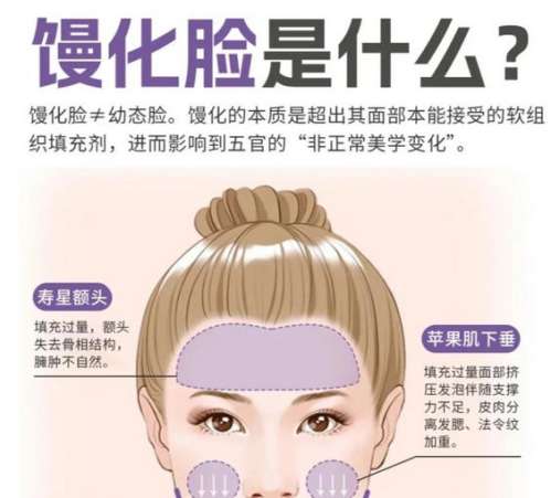 钱云良 九院案例取注射物怎么样？面诊全过程分享|术后自然不垮脸