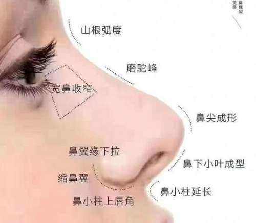 隆鼻 隆鼻