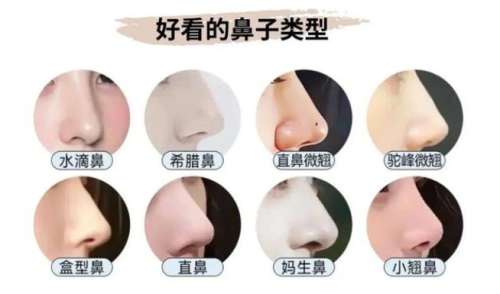 隆鼻 隆鼻