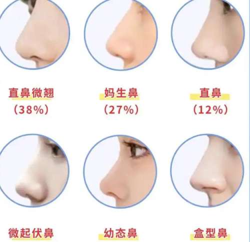 隆鼻 隆鼻