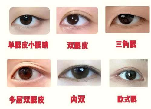 双眼皮 双眼皮