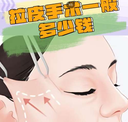 拉皮 拉皮