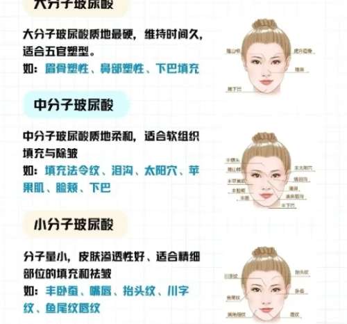 面部填充科普3.jpg