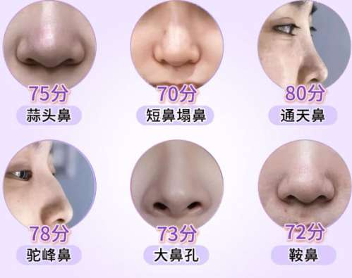 隆鼻 隆鼻