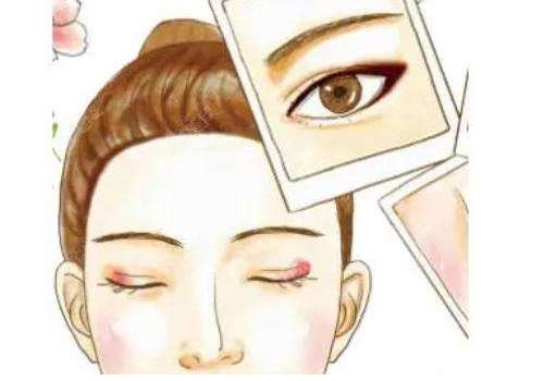 科普双眼皮4.jpg