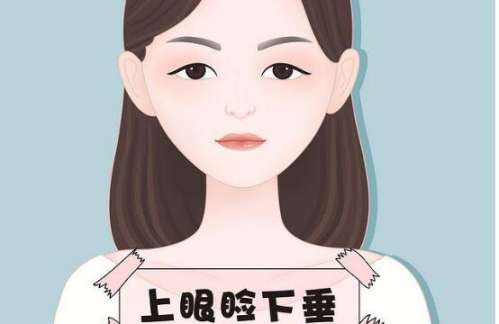 上睑下垂 上睑下垂
