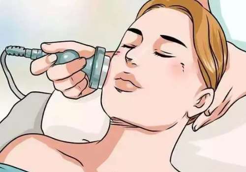 激光美白.jpg