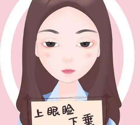 上睑下垂 上睑下垂