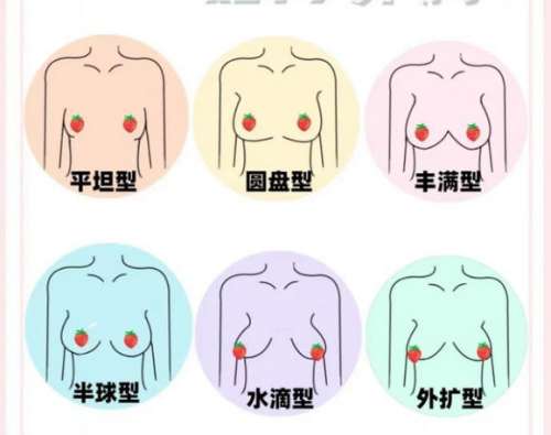 隆胸 隆胸