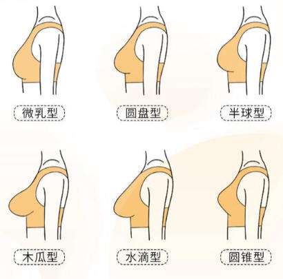 隆胸 隆胸