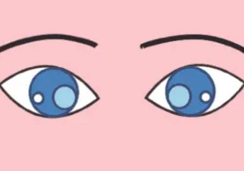 单眼皮3.jpg