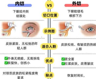 去眼袋 去眼袋