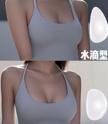 隆胸 隆胸