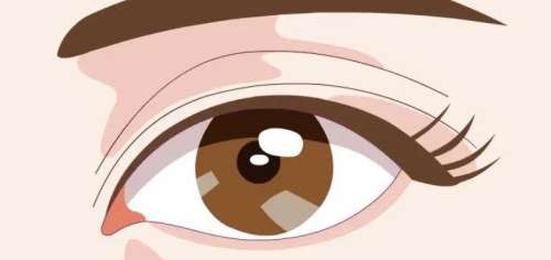 开眼角 开眼角