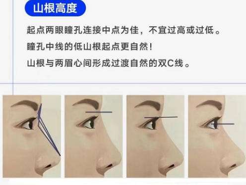 隆鼻13.jpg