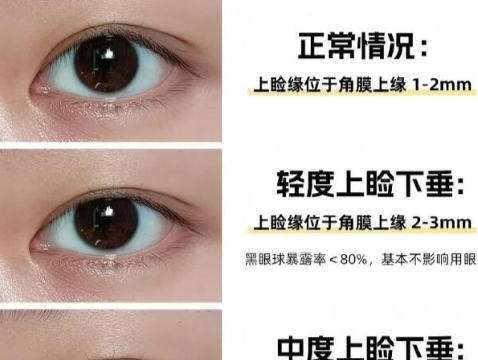 眼综合1.jpg
