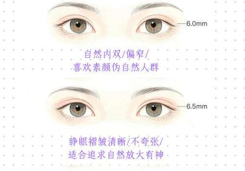 双眼皮   1.jpg