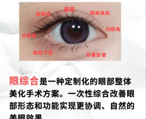 眼综合.jpg