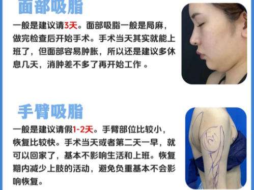 抽脂1.jpg