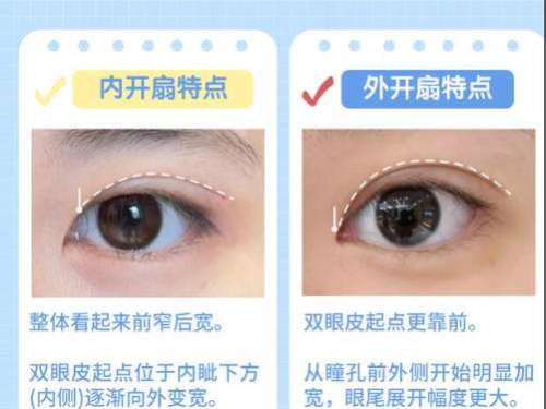 双眼皮7.jpg