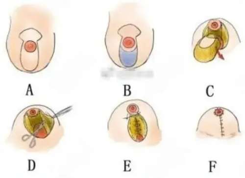 乳房 乳房