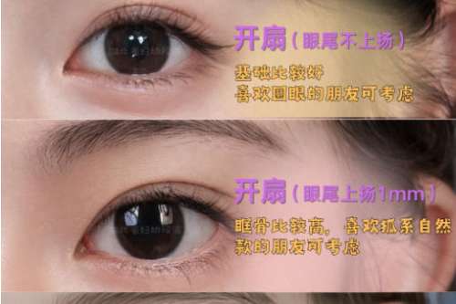 双眼皮 2.jpg 双眼皮 2.jpg
