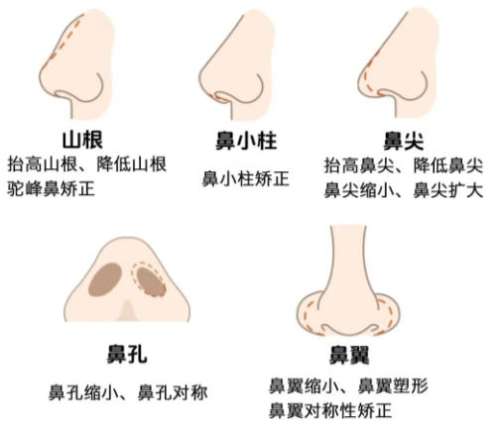 隆鼻4.jpg