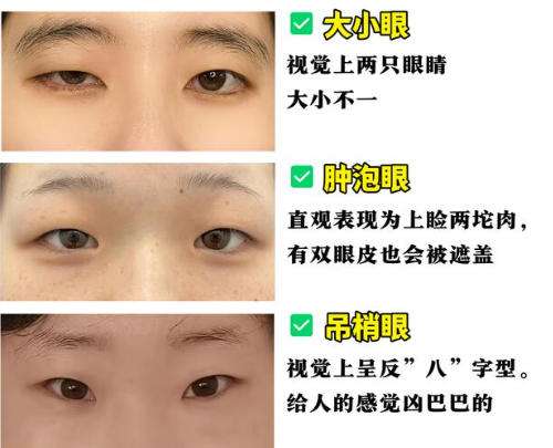 双眼皮8.jpg