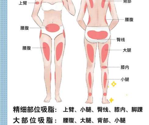 吸脂.jpg