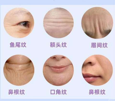 除皱2.jpg 除皱2.jpg
