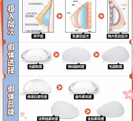 隆胸 隆胸