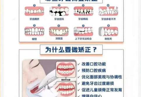正颌1.jpg 正颌1.jpg
