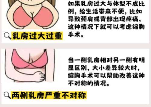 缩胸.jpg 缩胸.jpg