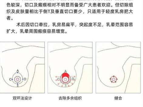 缩胸1.jpg 缩胸1.jpg
