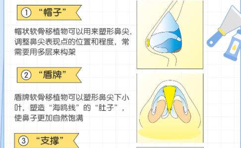 隆鼻9.jpg 隆鼻9.jpg