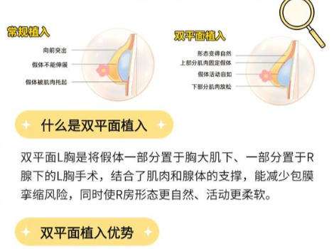 隆胸6.jpg 隆胸6.jpg