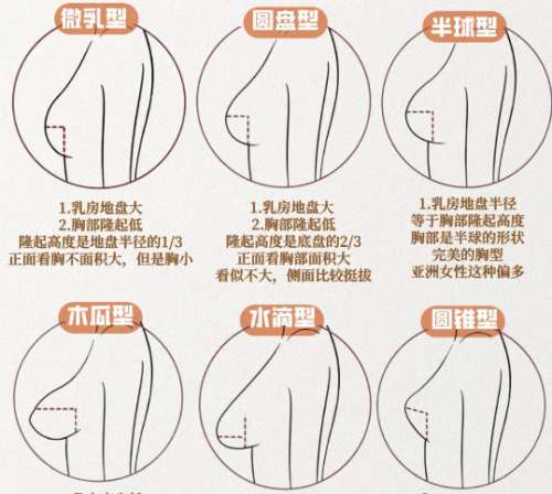 隆胸 隆胸