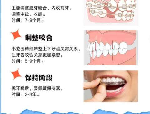 牙齿矫正8.jpg 牙齿矫正8.jpg