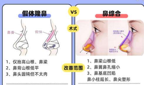 隆鼻3.jpg 隆鼻3.jpg