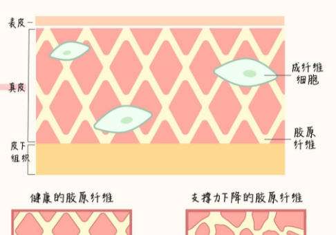 除皱.jpg 除皱.jpg