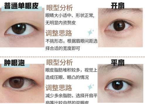 双眼皮3.jpg 双眼皮3.jpg
