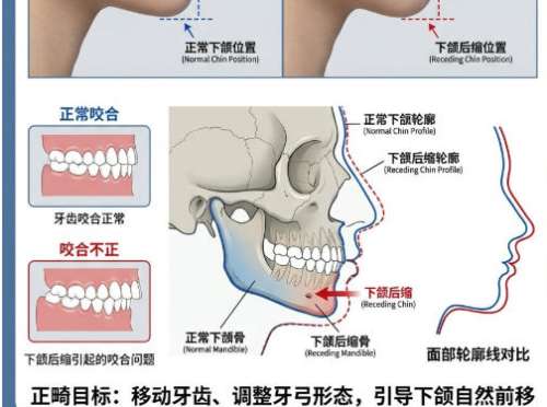 牙齿矫正4.jpg 牙齿矫正4.jpg