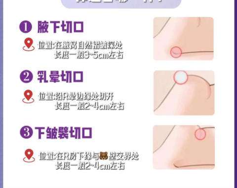 隆胸9.jpg 隆胸9.jpg