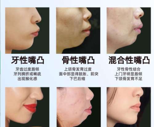 牙齿矫正7.jpg 牙齿矫正7.jpg