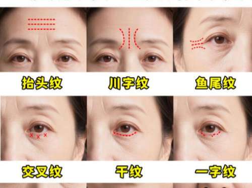除皱1.jpg 除皱1.jpg