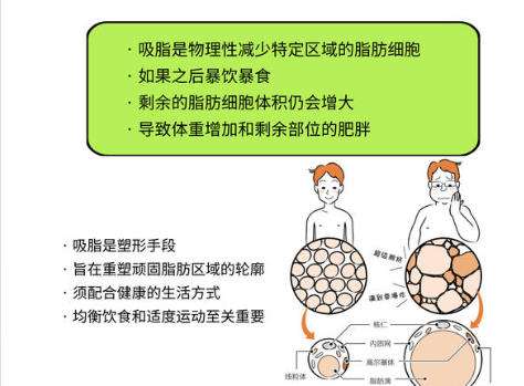 吸脂1.jpg 吸脂1.jpg